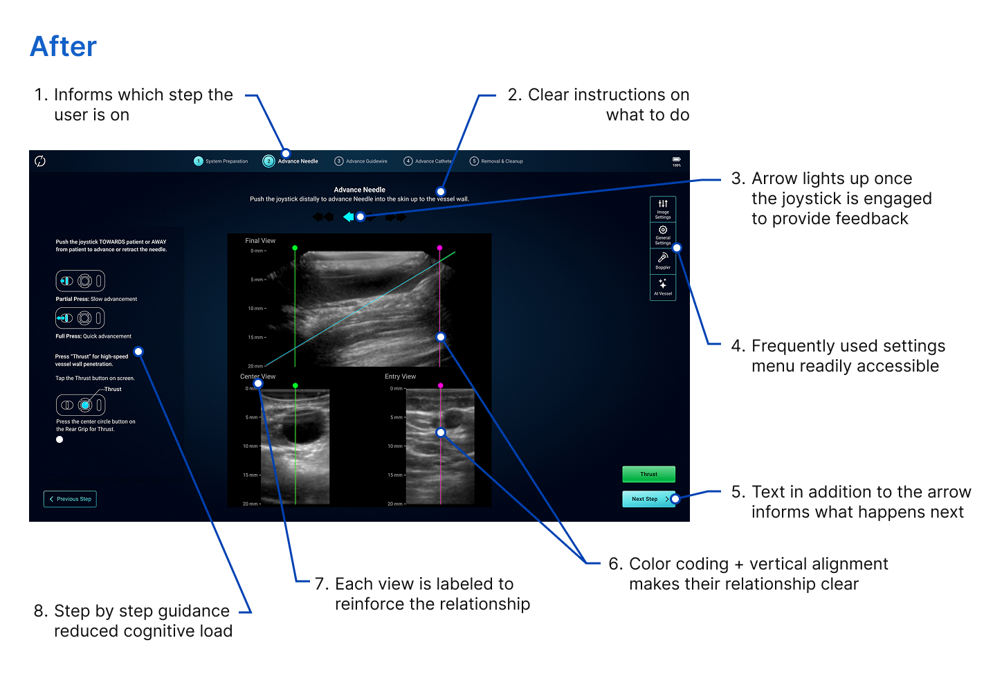 After: redesigned interface annotated with eight usability improvements, including a persistent step indicator and color-coded ultrasound views