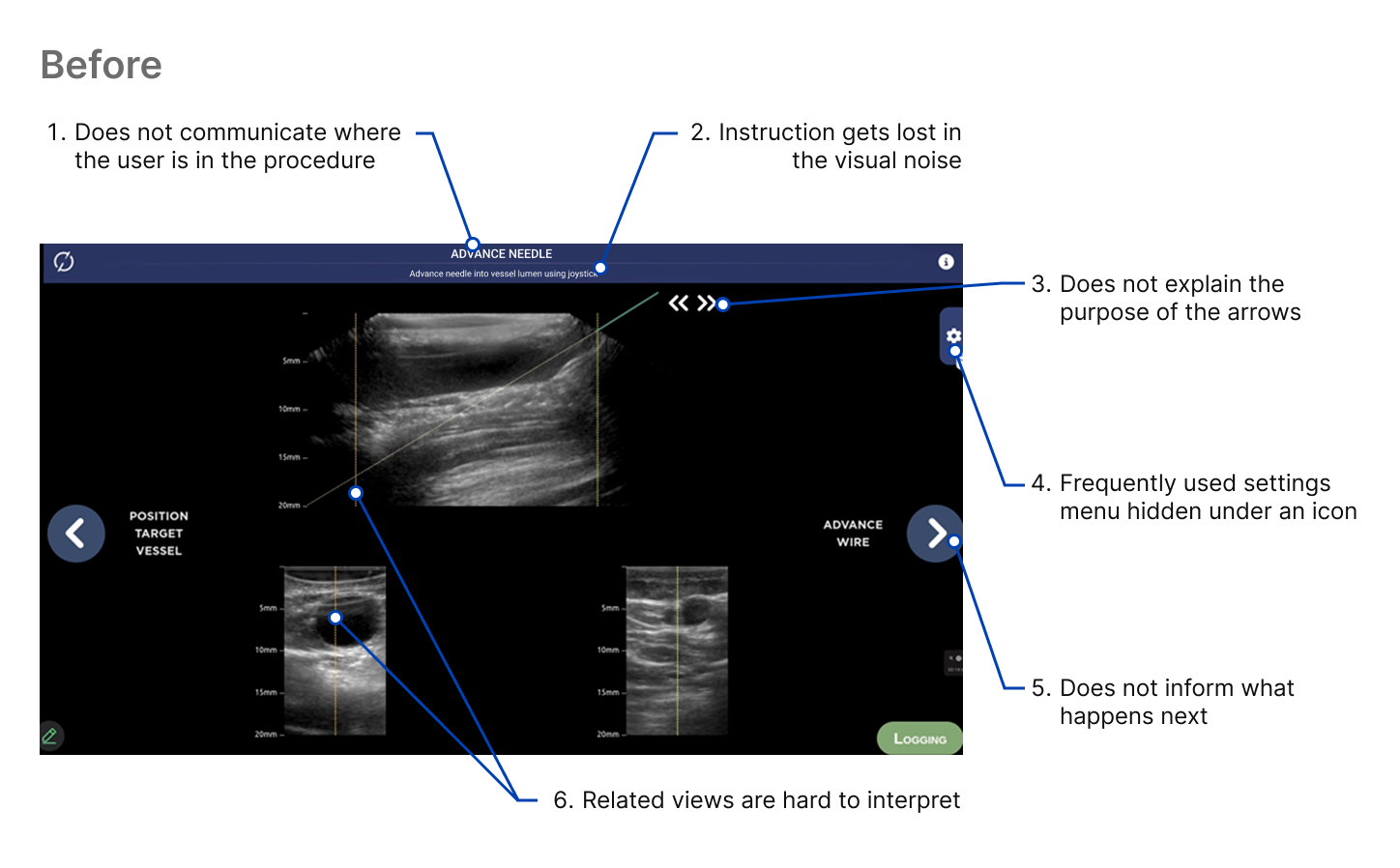 Before: original interface annotated with six usability problems, including no sense of location in the procedure and buried settings
